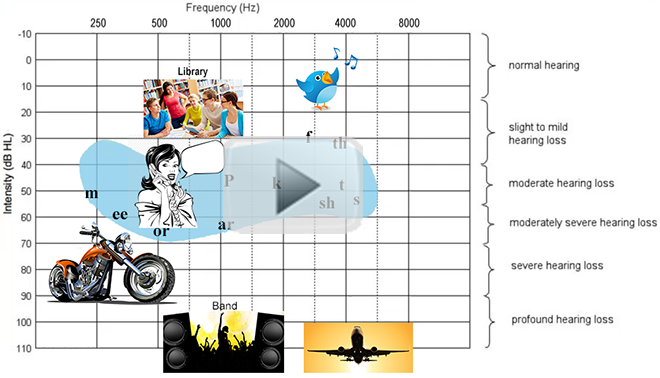 Understanding your audiogram